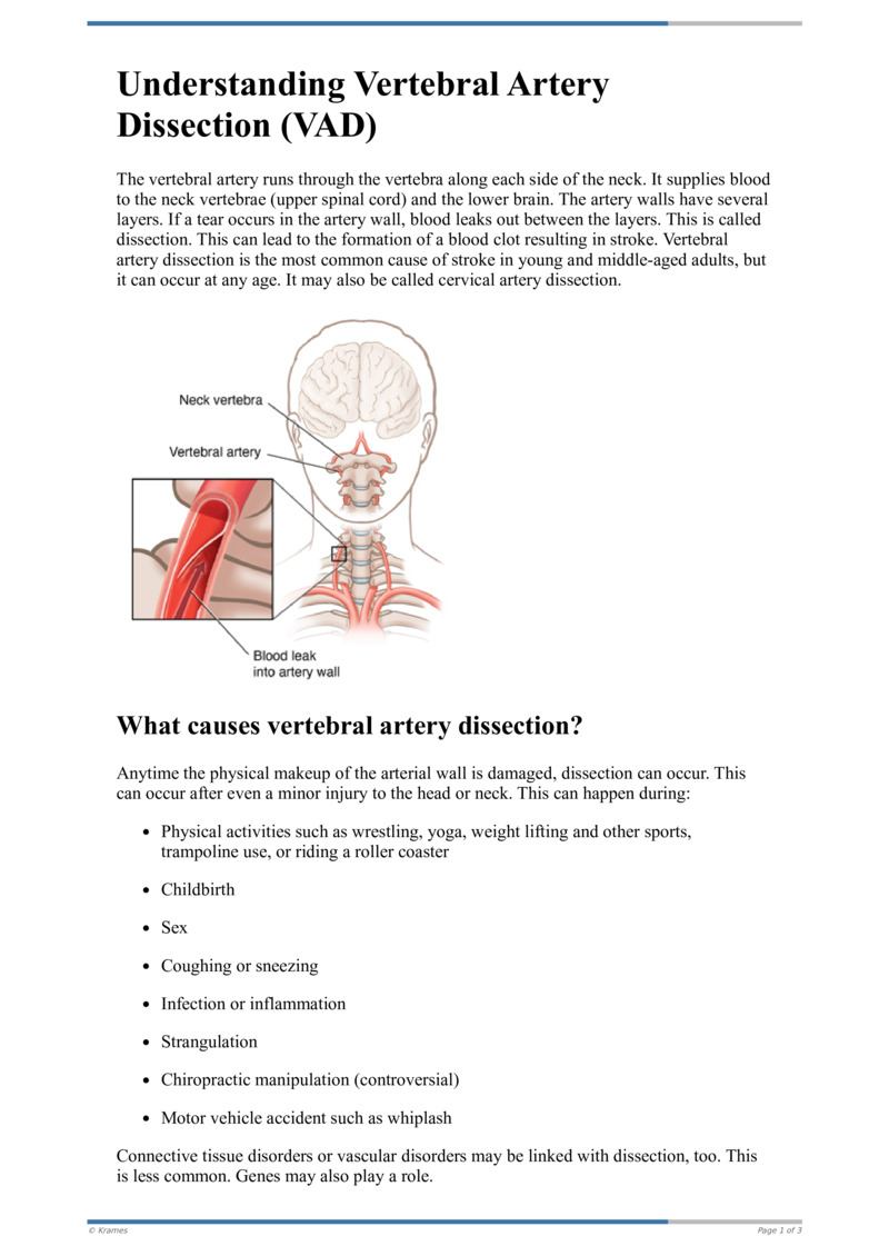 Text Understanding Vertebral Artery Dissection Vad Healthclips Online