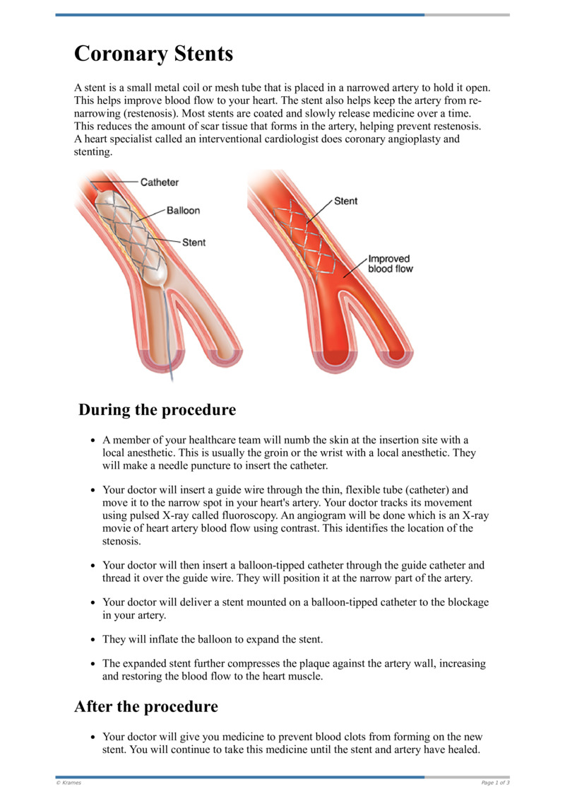 Text Coronary Stents Healthclips Online