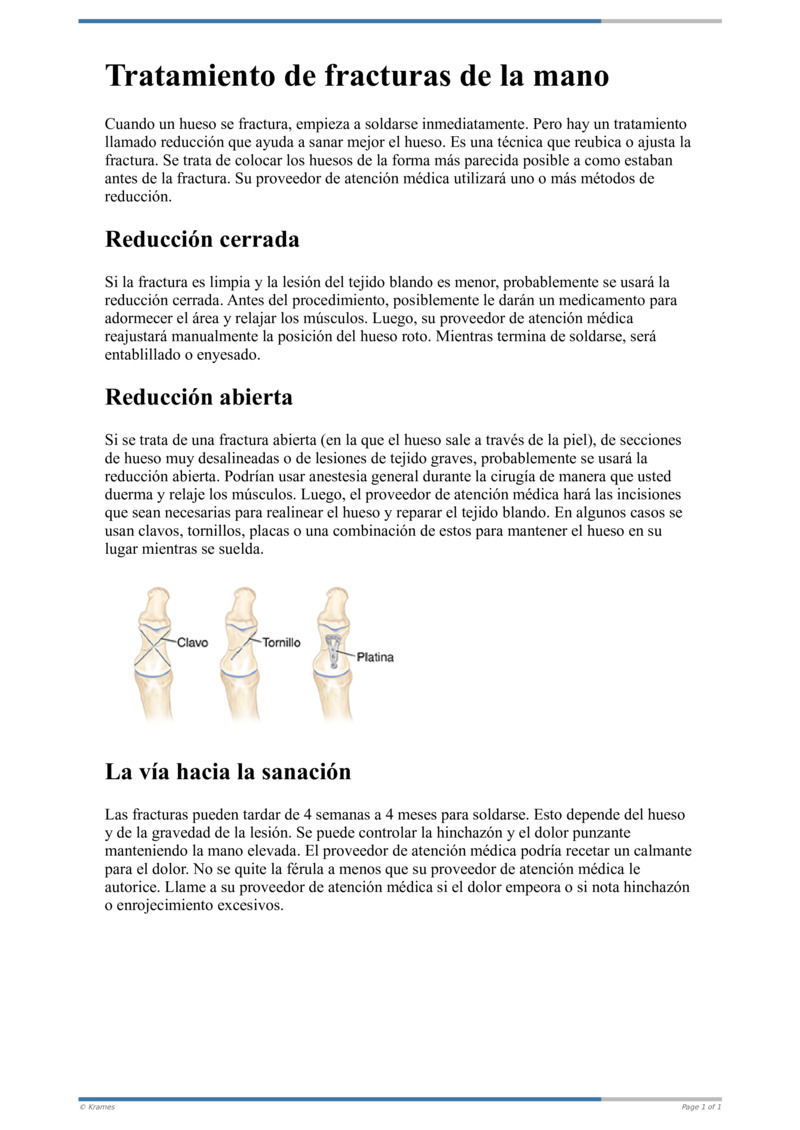 Text Tratamiento De Fracturas De La Mano HealthClips Online