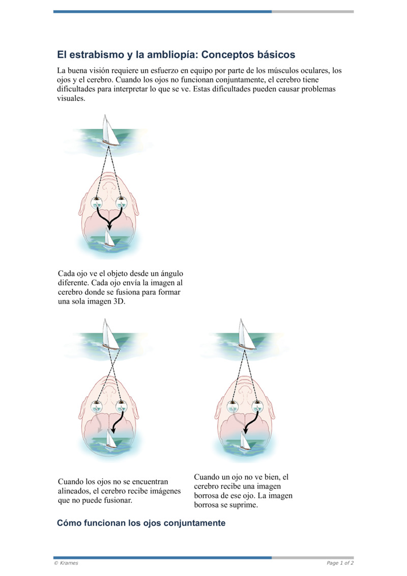 Pdf El Estrabismo Y La Ambliop A Conceptos B Sicos Healthclips Online