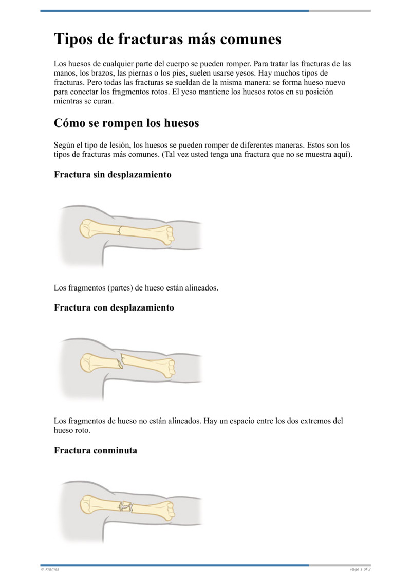 Text Tipos De Fracturas M S Comunes Healthclips Online