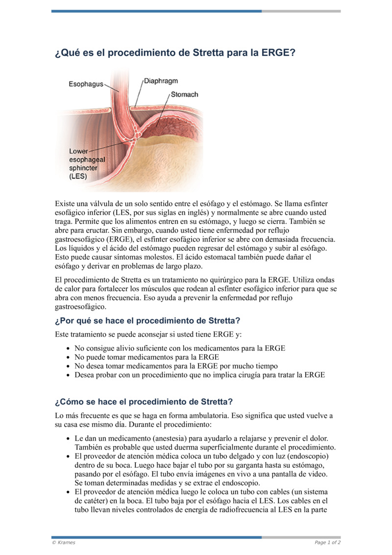 PDF Qué es el procedimiento de Stretta para la ERGE HealthClips