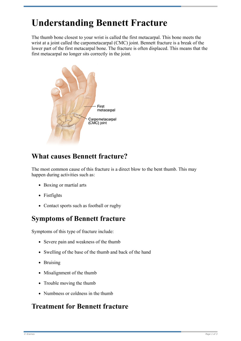 Text Understanding Bennett S Fracture HealthClips Online