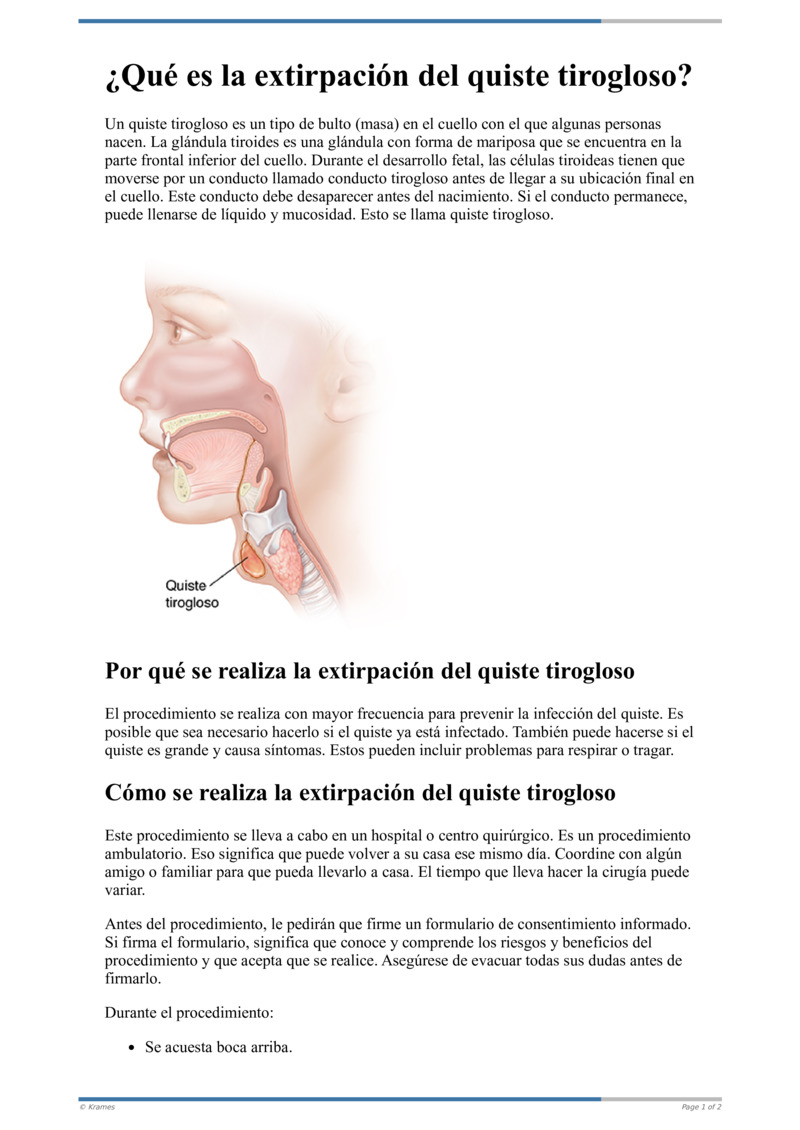 Text Qu Es La Extirpaci N Del Quiste Tirogloso Healthclips Online