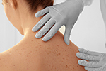 Thumbnail image for the Subject "Dermatología"
