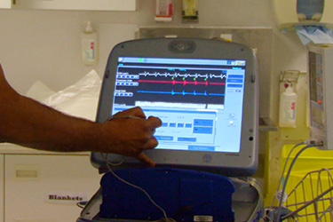 Thumbnail image for "Antes de y durante la Intervención para el Implante del DCI"