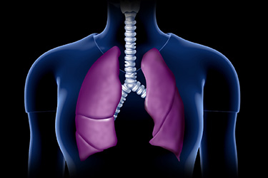 Thumbnail image for "Lung Cancer"