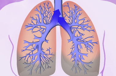 Thumbnail image for "Pneumonia: The Importance of an Early Diagnosis"