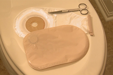 Thumbnail image for "Your Care at Home: Ileostomy Care"