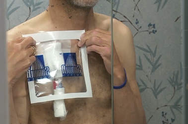Thumbnail image for "Living with Your Central Venous Catheter for Hemodialysis"