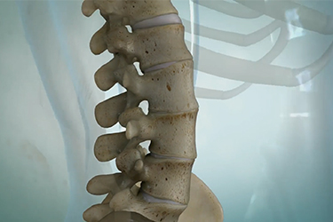 Thumbnail image for "Ankylosing Spondylitis"