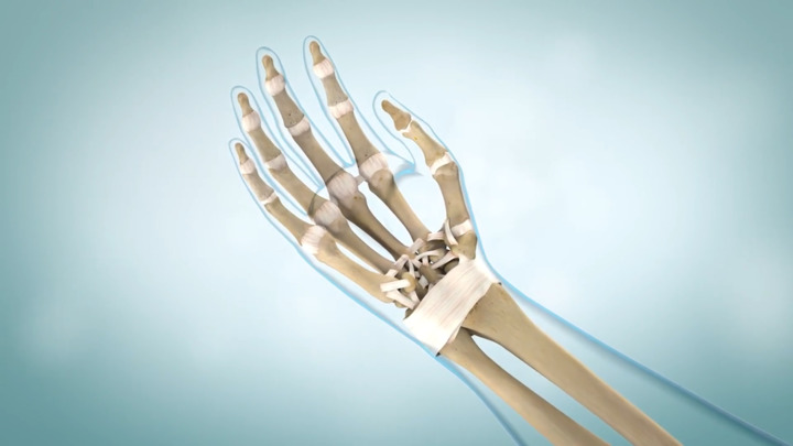 Video - Arthritis of the Hand - HealthClips Online