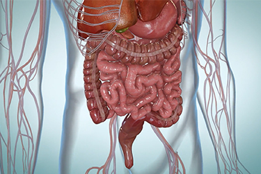 Thumbnail image for "Diverticulitis"