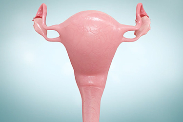 Thumbnail image for "Endometriosis"