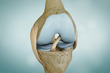 Thumbnail image for "Osteoarthritis"
