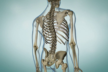 Thumbnail image for "Scoliosis"