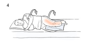 Thumbnail image for "Step-by-Step: Using Log-Roll to Get into Bed (Hip Care)"