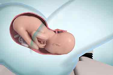 Thumbnail image for "Qué ocurre durante el trabajo de parto: segunda y tercera etapa"
