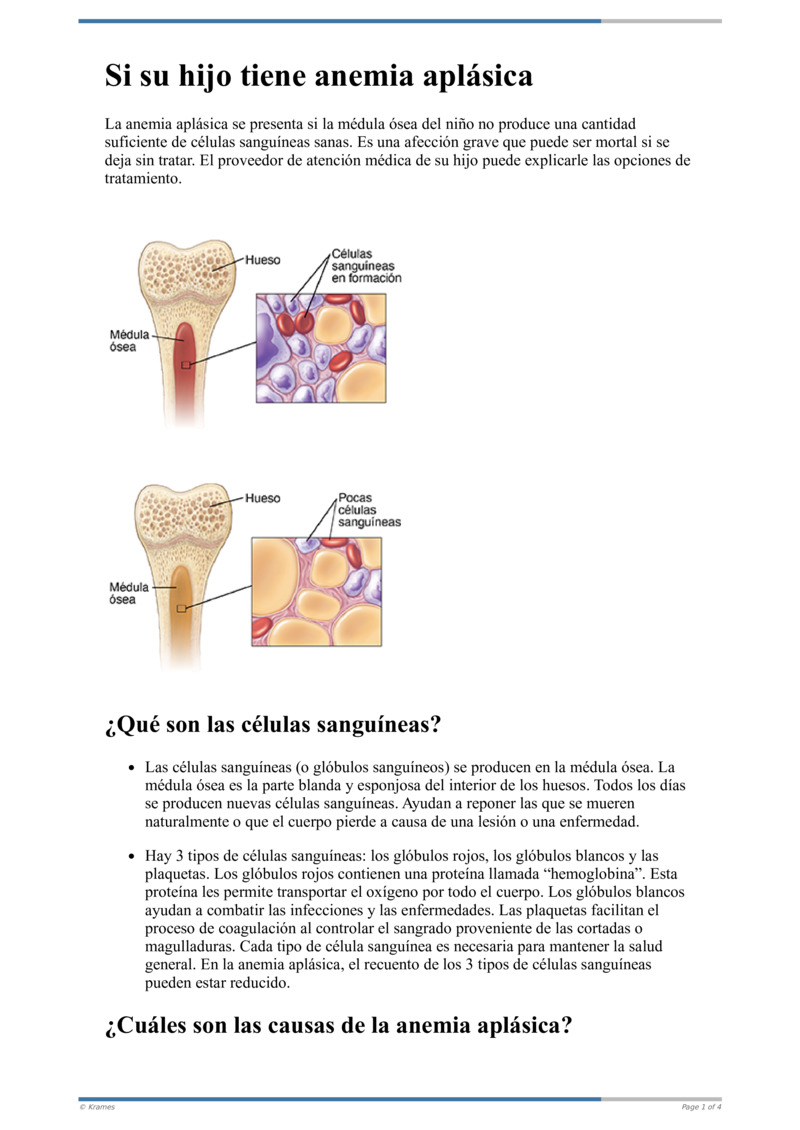 anemia aplásica médula ósea