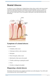 Thumbnail image for "Dental Abscess"