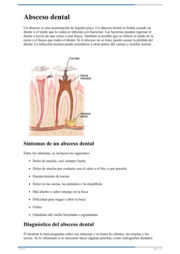 Thumbnail image for "Absceso dental"