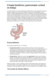 Thumbnail image for "La cirugía bariátrica: Gastrectomía vertical en manga"