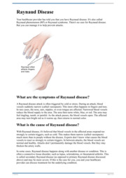 Thumbnail image for "Raynaud Disease"