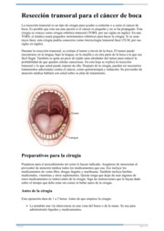 Thumbnail image for "Resección transoral para el cáncer de boca"