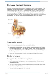 Thumbnail image for "Cochlear Implant Surgery"