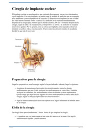 Thumbnail image for "Cirugía de implante coclear"
