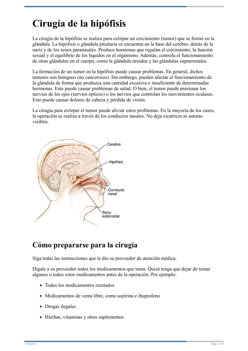 Poster image for "Cirugía de la glándula pituitaria"