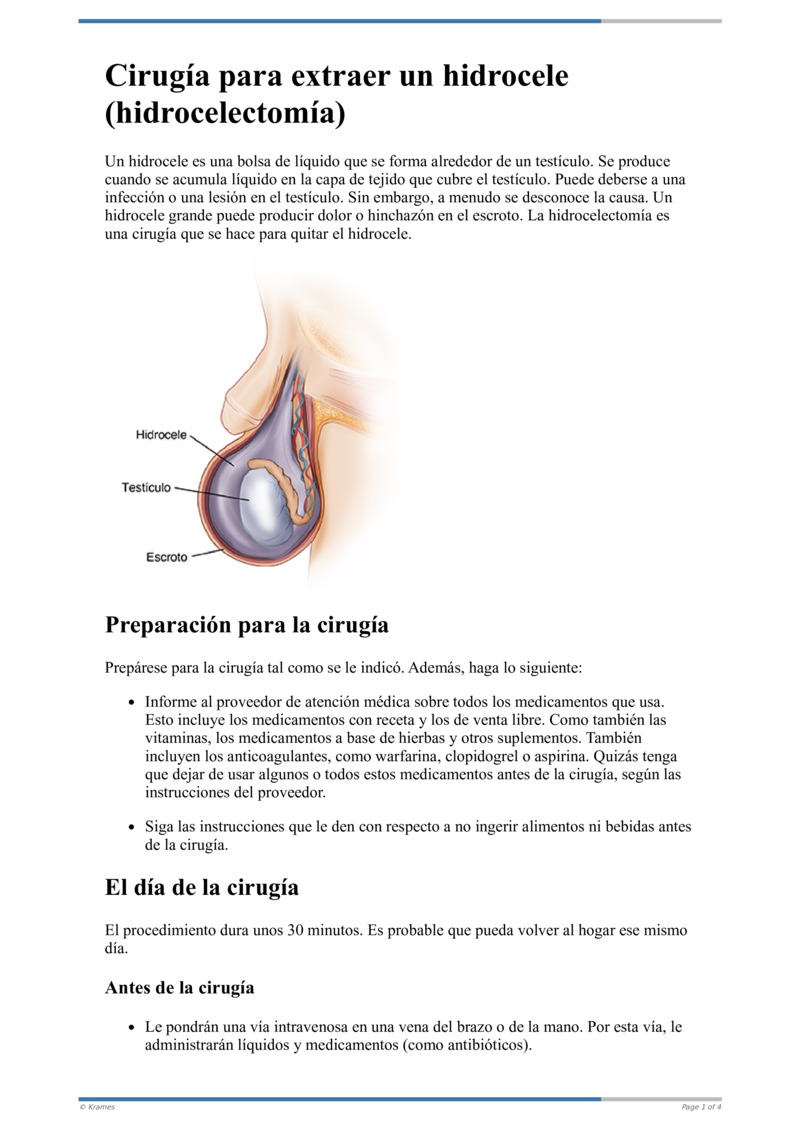 tratamiento de hidrocele