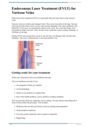 Thumbnail image for "Endovenous Laser Treatment (EVLT) for Varicose Veins"