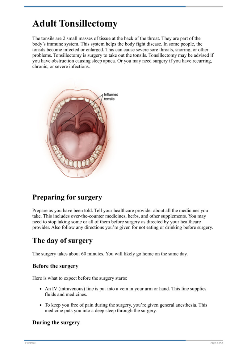 Poster image for "Adult Tonsillectomy"