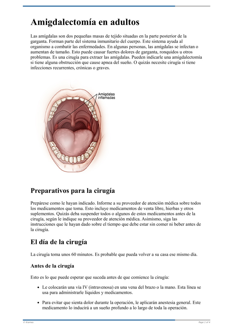 Poster image for "Amigdalectomía en adultos"