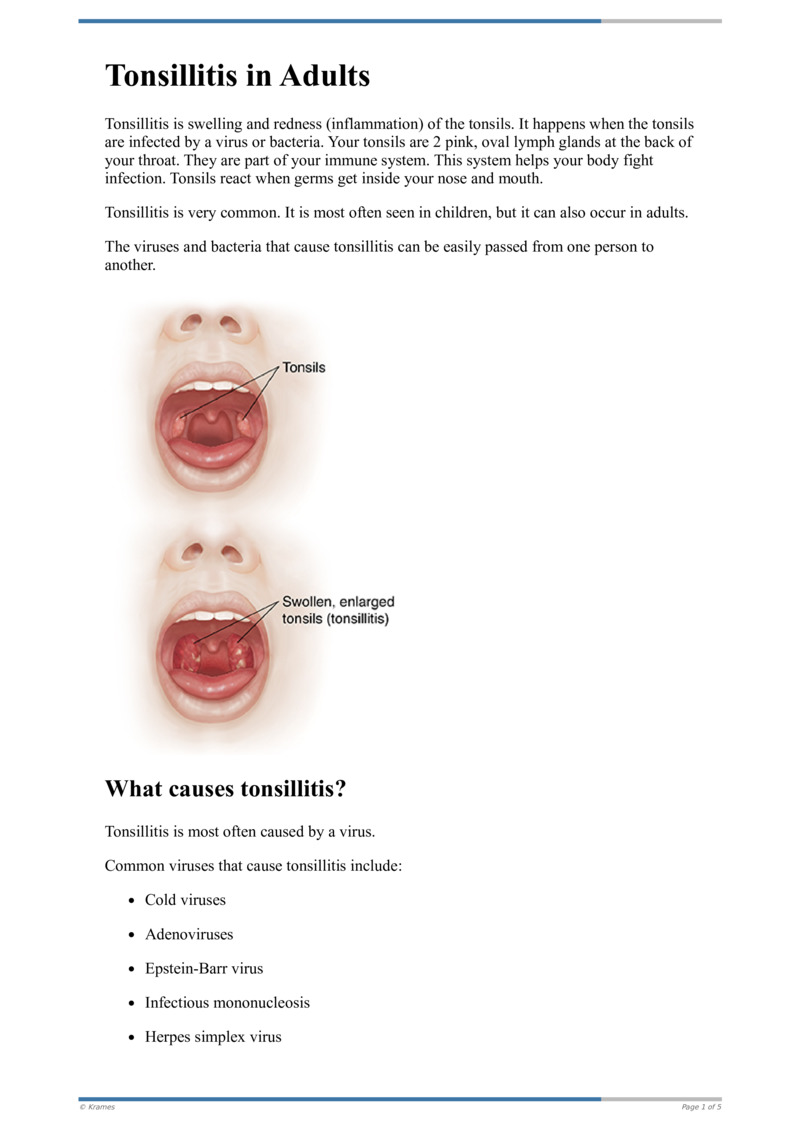 Poster image for "Tonsillitis in Adults"