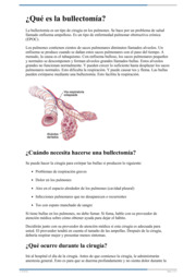 Thumbnail image for "¿Qué es la bullectomía?"