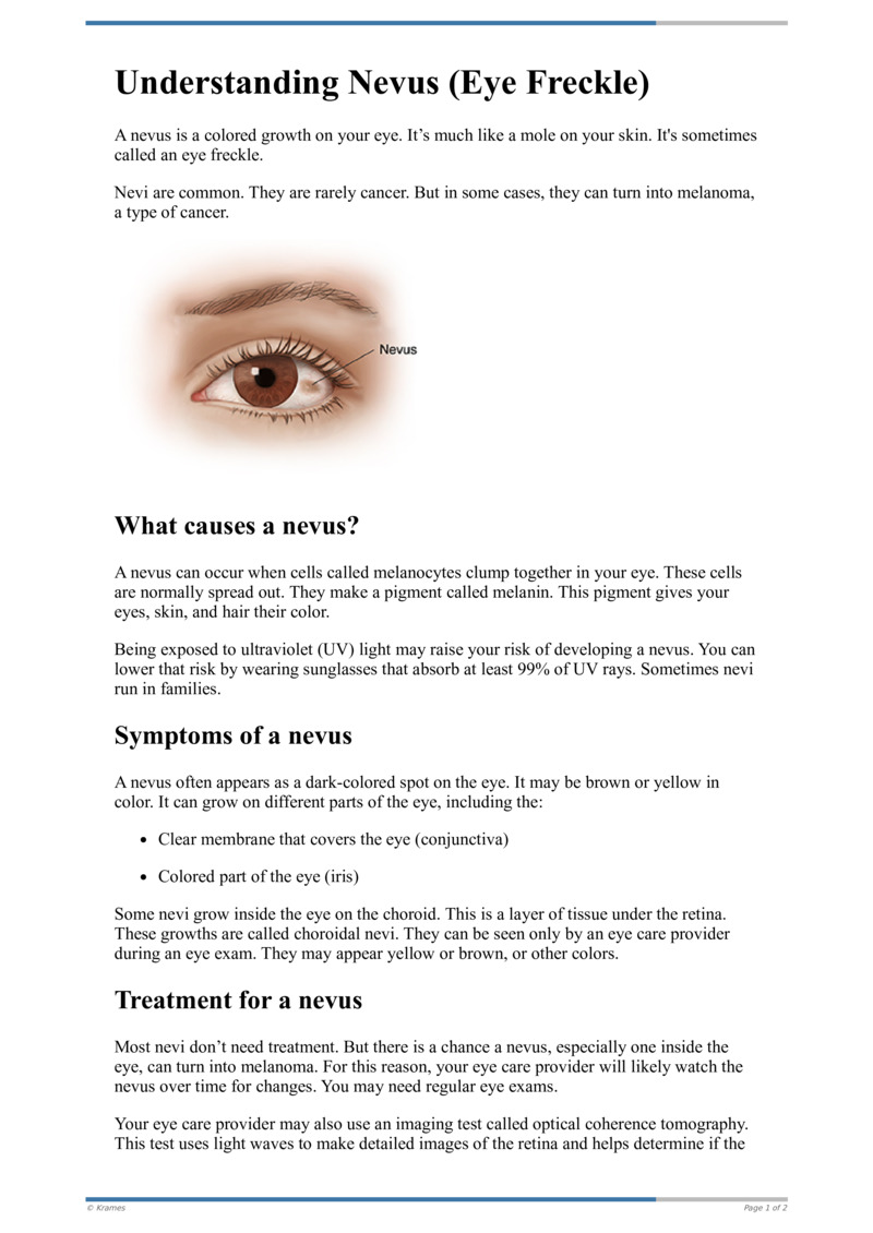 Text - Understanding Nevus (Eye Freckle) - HealthClips Online