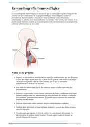 Thumbnail image for "Ecocardiografía transesofágica"