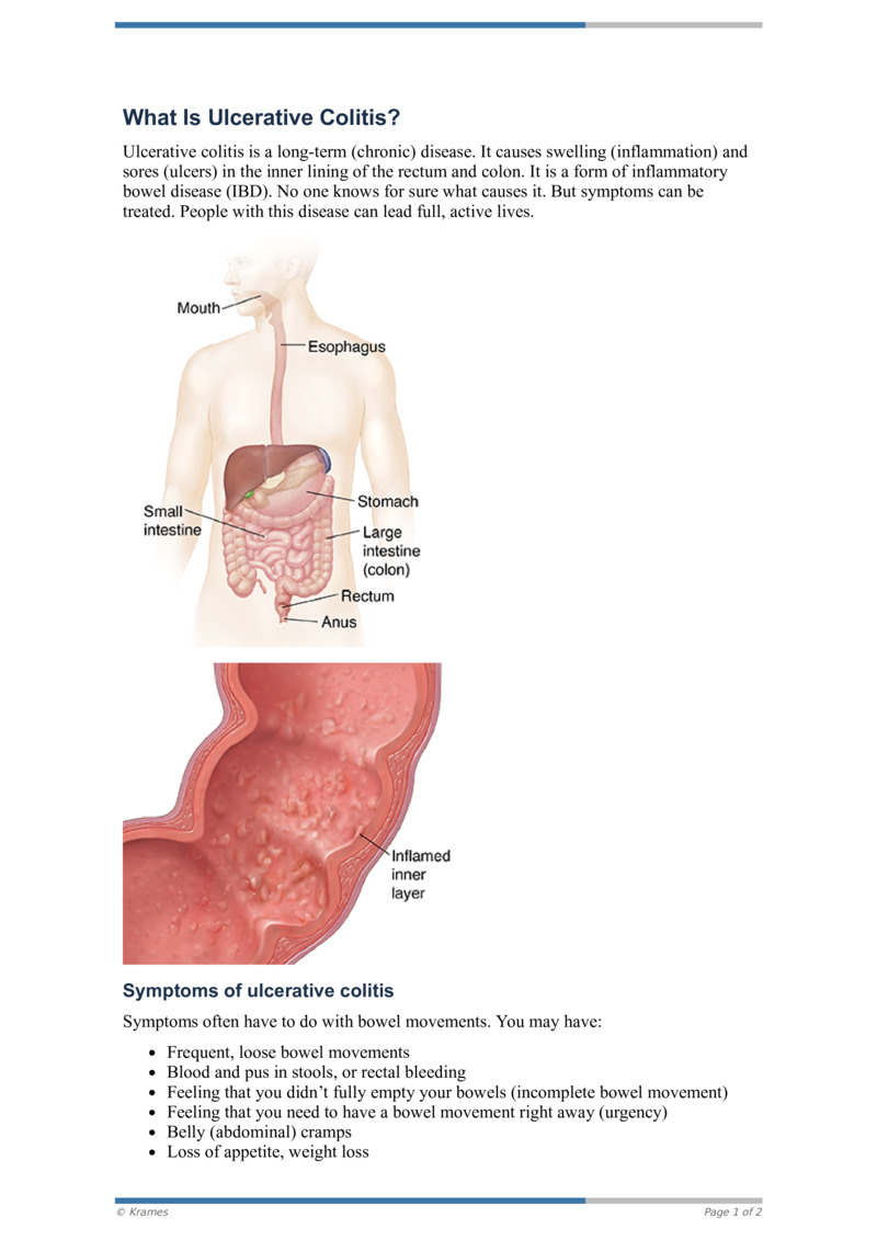 Pdf What Is Ulcerative Colitis Healthclips Online