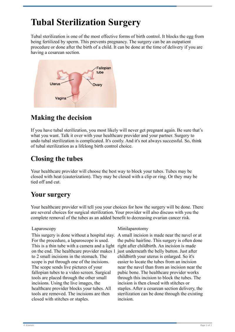 Text Tubal Sterilization Surgery HealthClips Online
