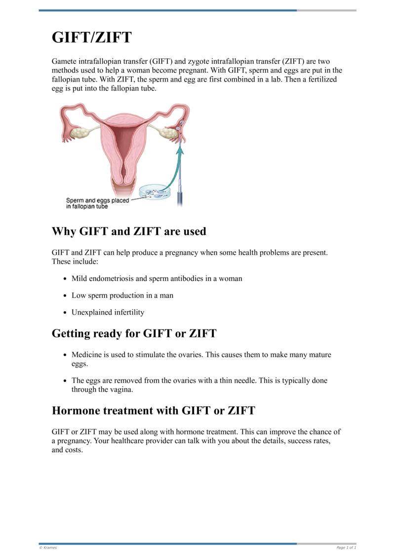 GIFT and ZIFT Treatment for Infertility: Reasons, Risks, Costs