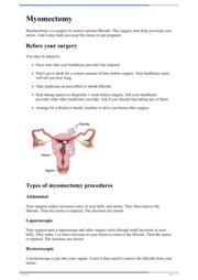 Thumbnail image for "Myomectomy"