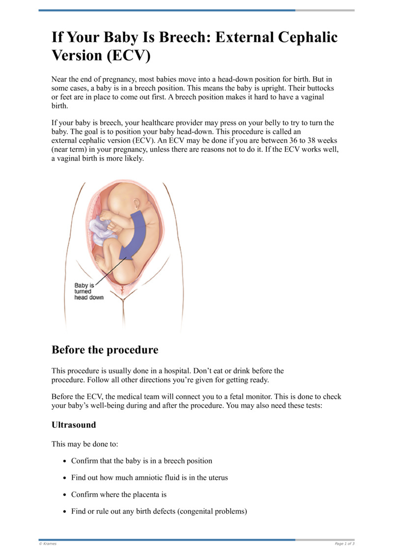 text-if-your-baby-is-breech-external-cephalic-version-ecv