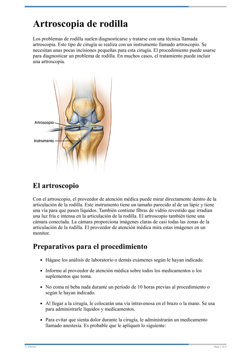 Spanish HIE Multimedia - Artroscopia de rodilla
