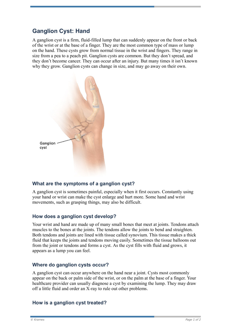 PDF Ganglion Cyst Hand HealthClips Online
