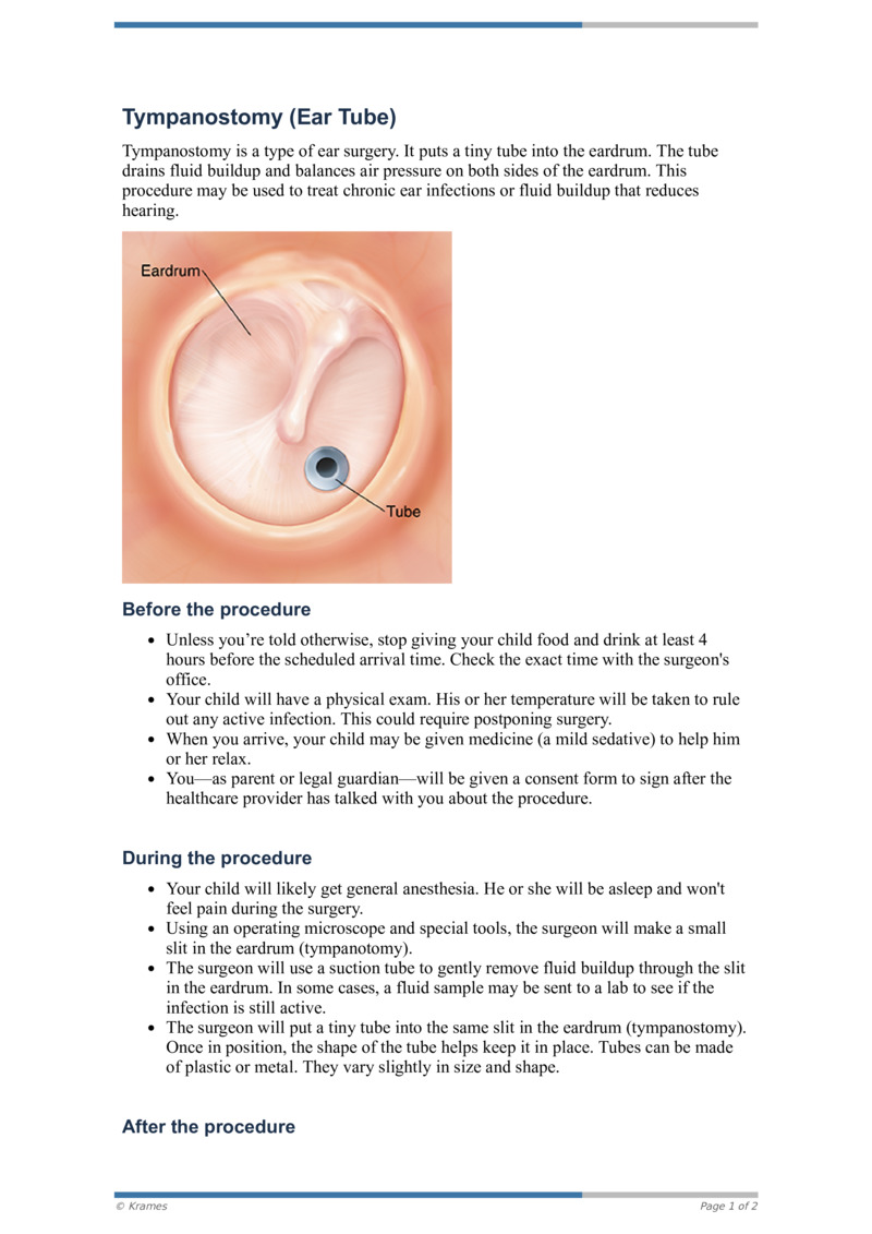 Pdf Tympanostomy Ear Tube Healthclips Online 8229