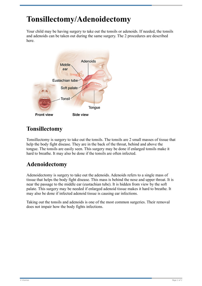 Text Tonsillectomyadenoidectomy Healthclips Online