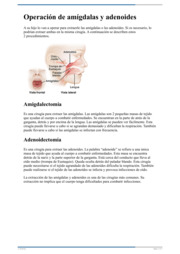 Thumbnail image for "Operación de amígdalas y adenoides"