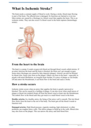 Back Fracture (Compression Fracture)